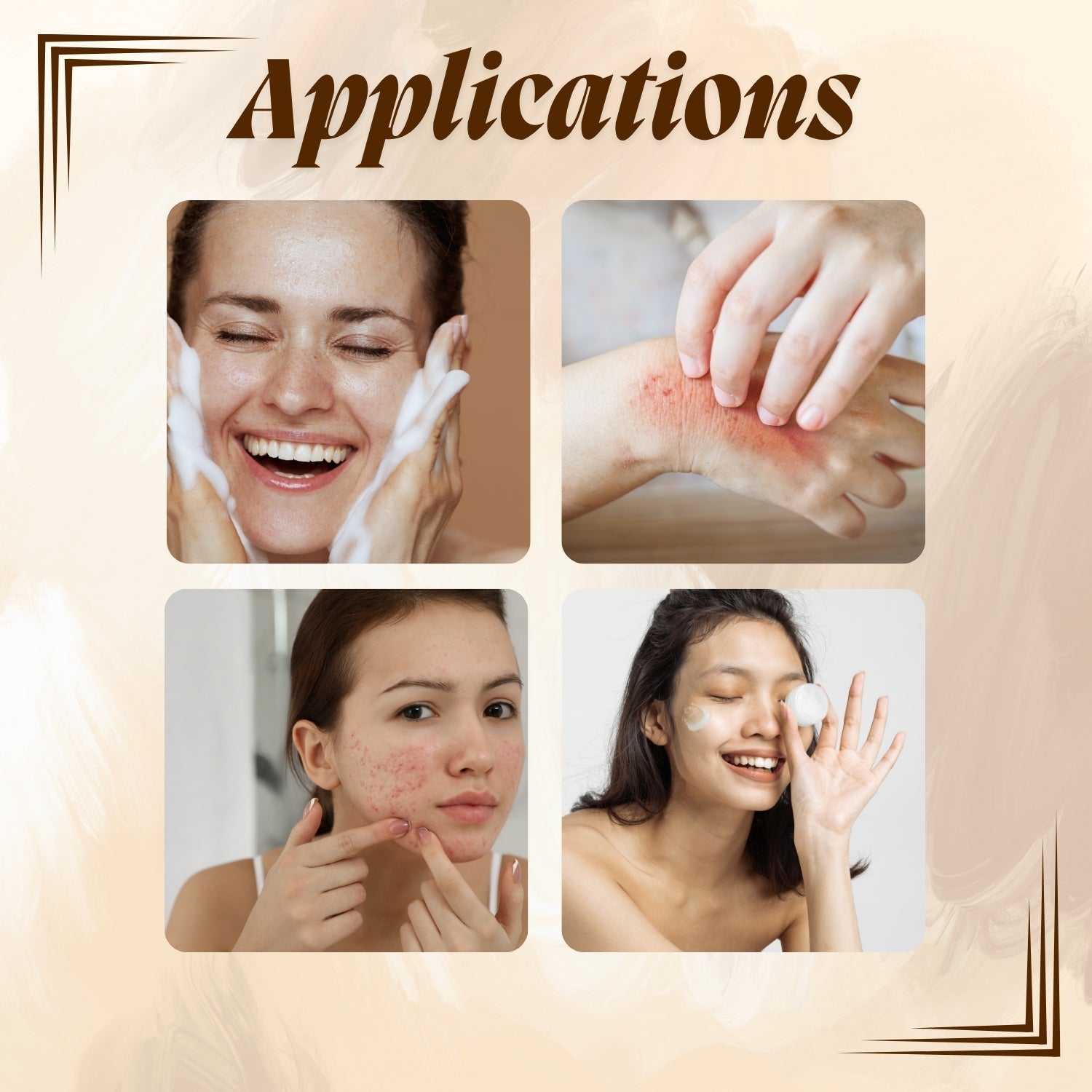 Calamine Soap Base